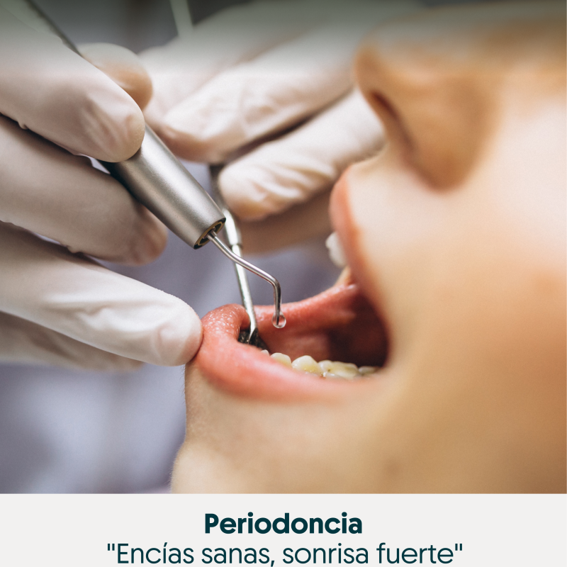  Periodoncia - Servicio dental especializado en Pasto