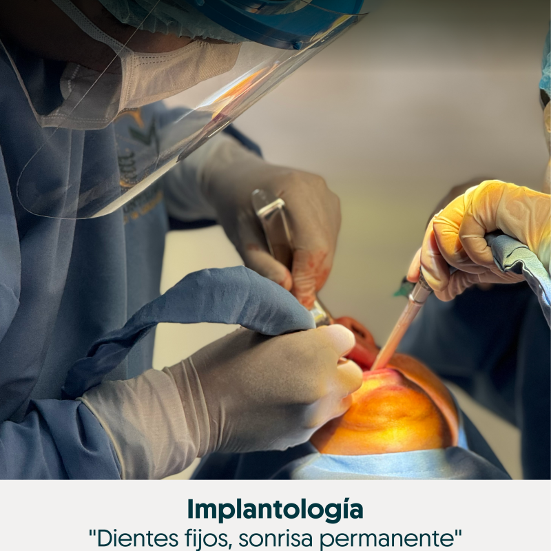  Implantologia - Servicio dental especializado en Pasto