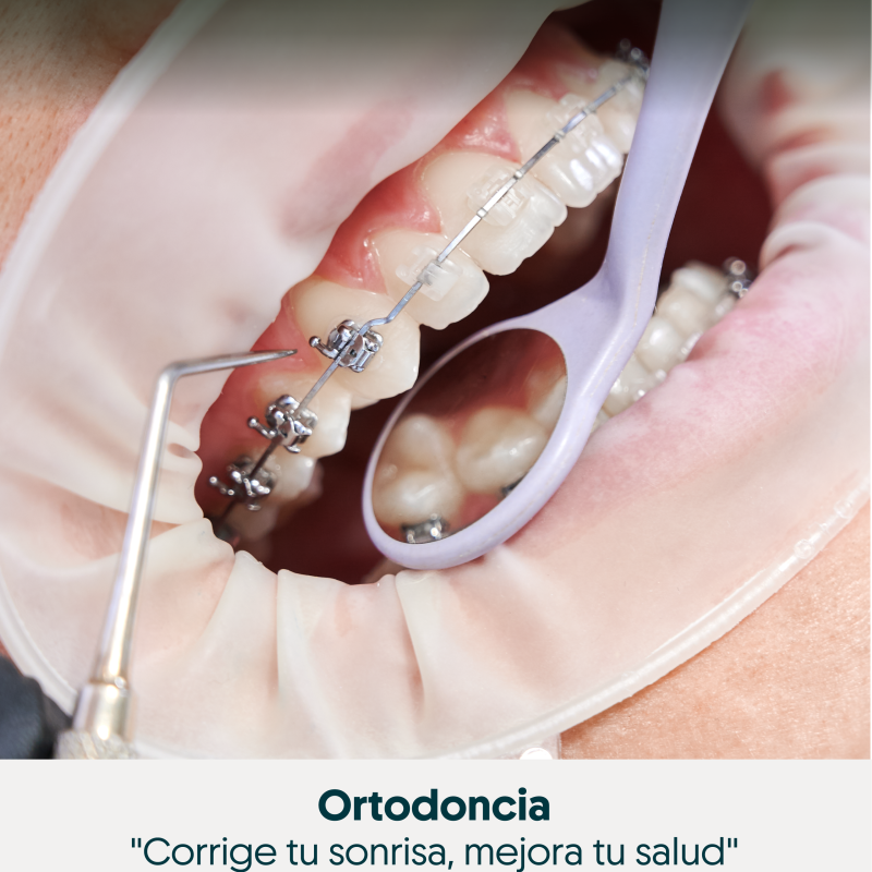  Ortodoncia - Servicio dental especializado en Pasto